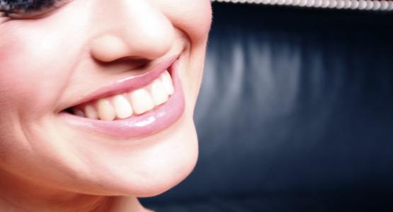 colla per faccette dentali, come incollare una faccetta dent