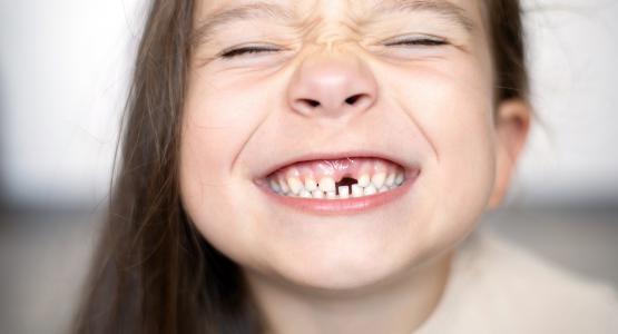 Denti piccoli