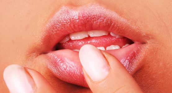 Faccette dentali migliori