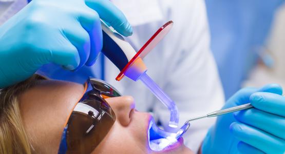 Ricostruzione smalto denti