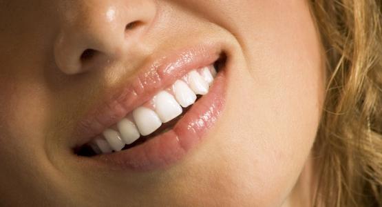 Kit sbiancamento denti