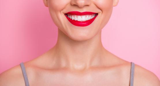 Sbiancamento dei denti