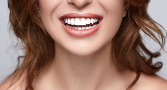 Sbiancamento denti fai da te