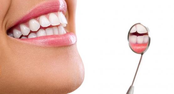 Sbiancamento denti opinioni