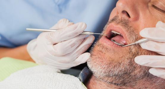 Ipomineralizzazione denti bambini