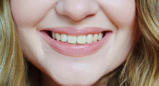 Come togliere il giallo del fumo dai denti