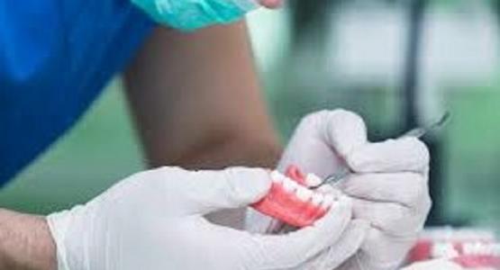 Implantologia dentale Padova