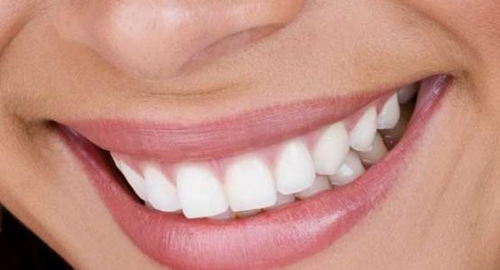 Sbiancamento denti Cuneo