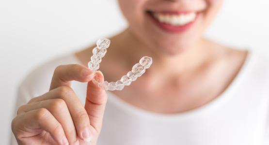 Invisalign lite