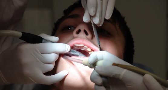 Occlusione dentale perfetta