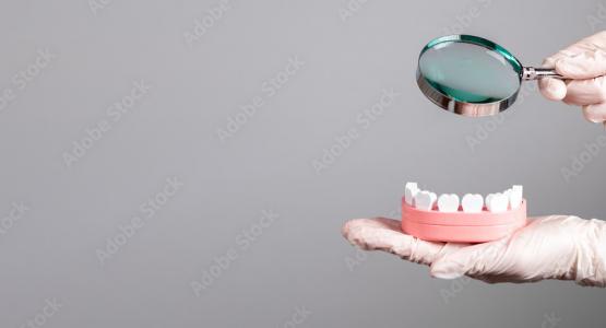 Spazio tra i denti