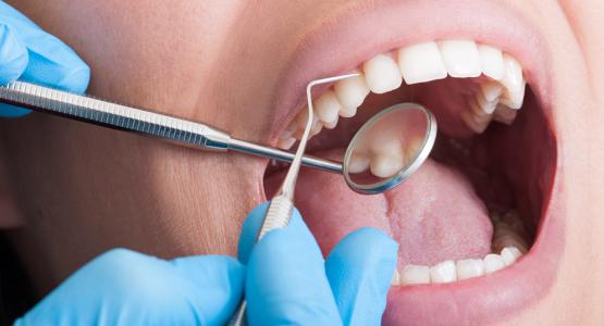 Endodonzia e otturazione