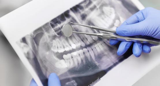 Strumenti Endodonzia