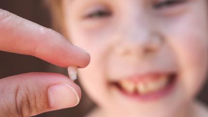 Avulsione dentale