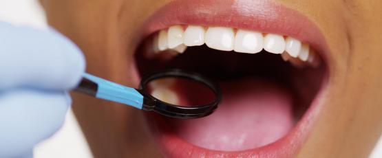 Dolore dopo estrazione dente molare