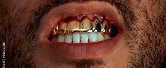 Grillz denti