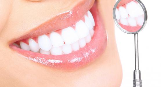 Bonding dentale