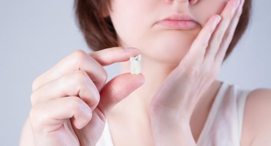 Cosa mangiare dopo estrazione dente