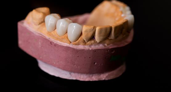 Di che materiale sono fatti i denti finti