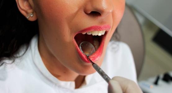 Estrazione dente