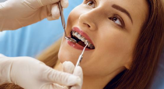 Estrazione denti per sovraffollamento
