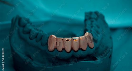 Grillz denti