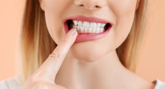 Ascesso dentale
