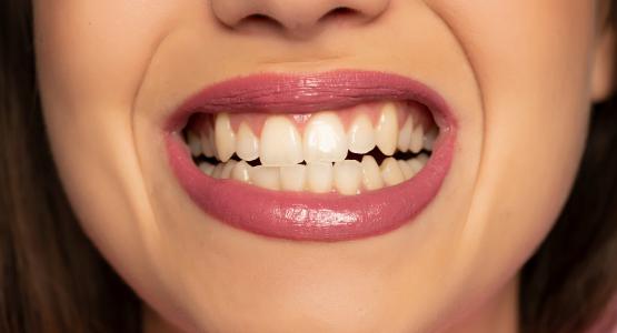 Digrignare i denti