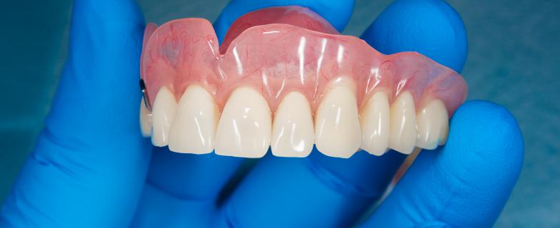 Dentiera finta: costi, materiali utilizzati, vantaggi e tipologie